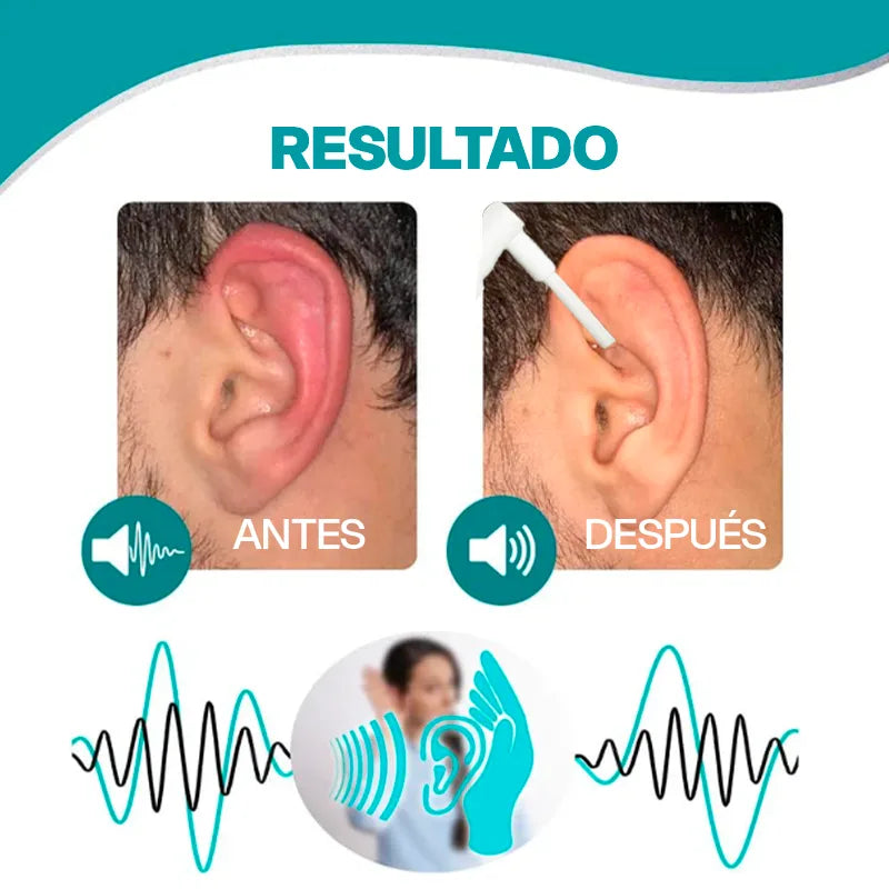 Tinnidrop™️ – El Spray Anti-Zumbido